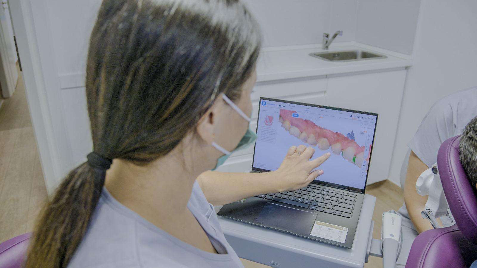 Elite Dental Hub Scanarea intraorala